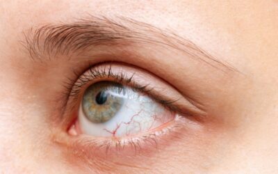 What Are the Two Main Causes of Dry Eyes?